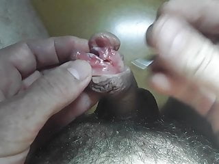 سوراخ اور subincision